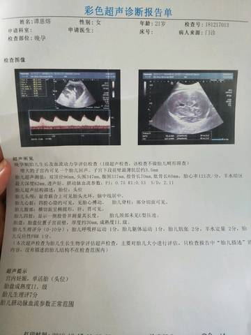 journal_insert_pic_1149631660