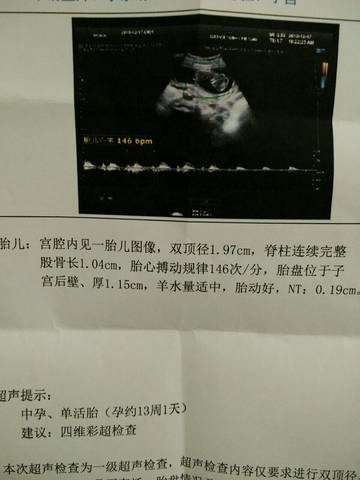 journal_insert_pic_1149733191