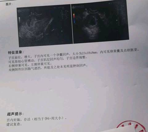 journal_insert_pic_1150120012