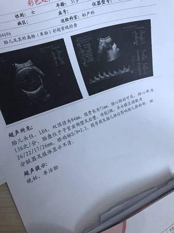 journal_insert_pic_1150312868