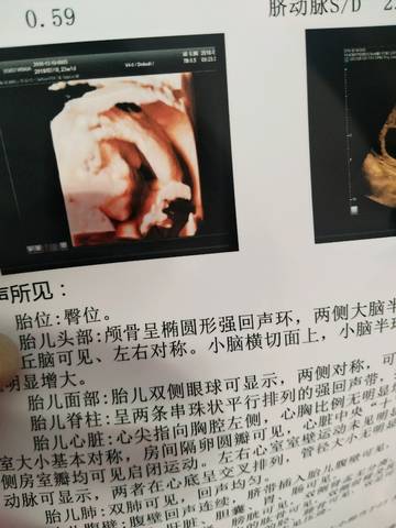 journal_insert_pic_1150744986