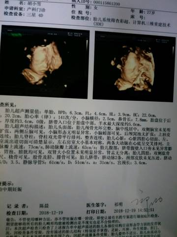 journal_insert_pic_1150854074