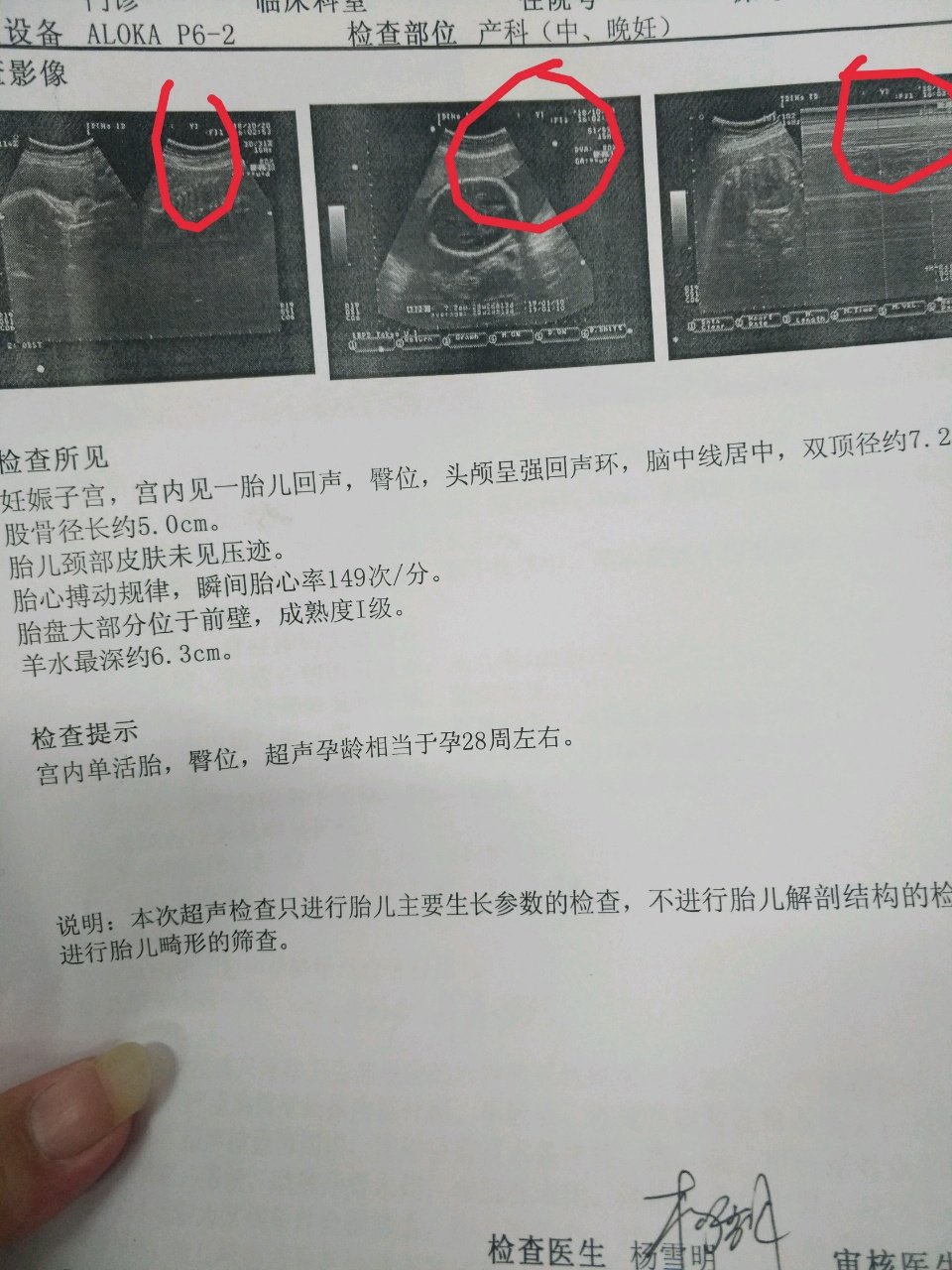 听说B超单上右上角显示的y代表男孩，x代表女孩是真的吗？