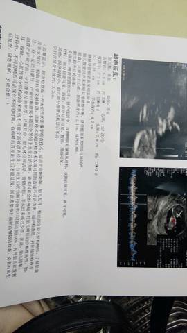 journal_insert_pic_1151382998