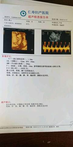 journal_insert_pic_1151223397