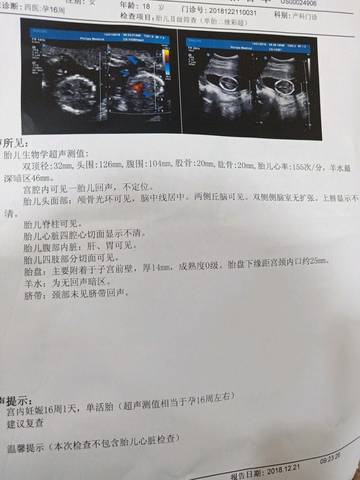 journal_insert_pic_1151767836