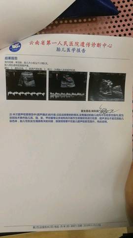 journal_insert_pic_1152279739