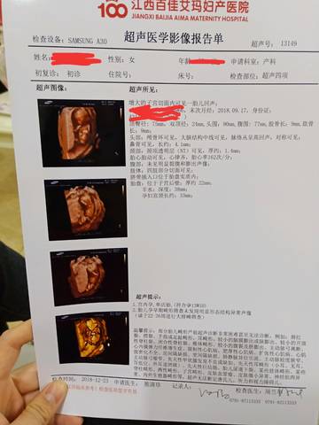 journal_insert_pic_1152975813