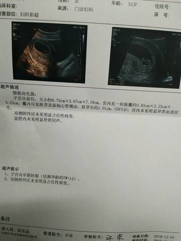 journal_insert_pic_1153698730