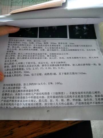 journal_insert_pic_1154962081