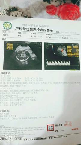 journal_insert_pic_1156168827