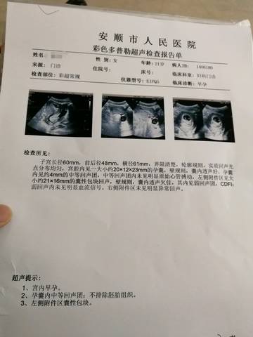 journal_insert_pic_1156012764