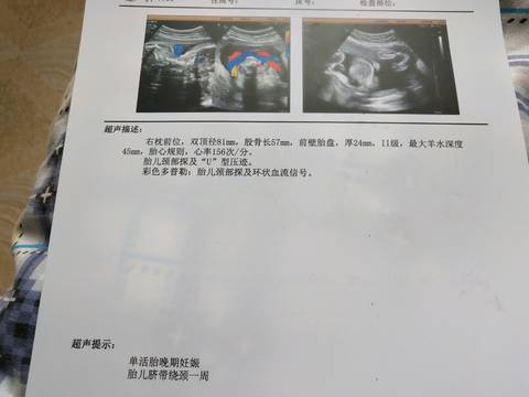 journal_insert_pic_1155985388