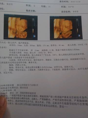 journal_insert_pic_1156526014