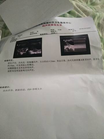 journal_insert_pic_1157450959