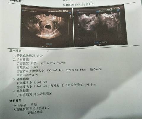 journal_insert_pic_1158045367