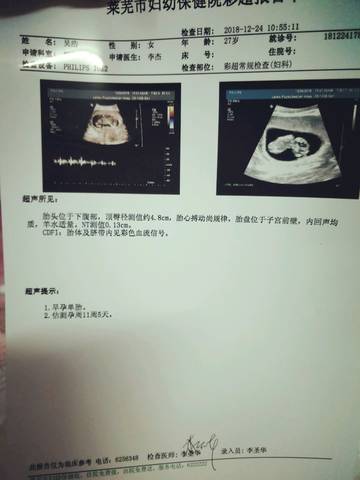 journal_insert_pic_1160023342