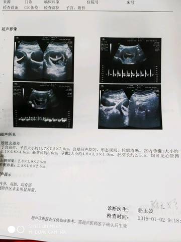 journal_insert_pic_1160386305