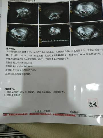 journal_insert_pic_1167038128