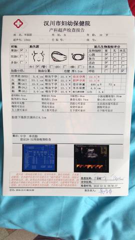 journal_insert_pic_1168122752