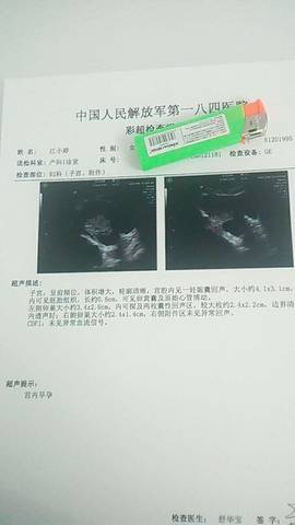 journal_insert_pic_1168635282