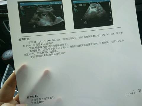 journal_insert_pic_1168569366