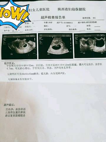 journal_insert_pic_1175261245