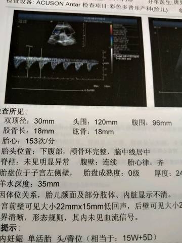 journal_insert_pic_1177419880