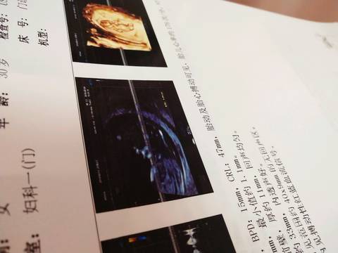 journal_insert_pic_1181637151