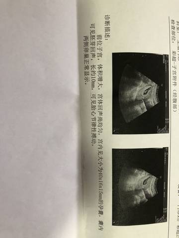 journal_insert_pic_1186961505