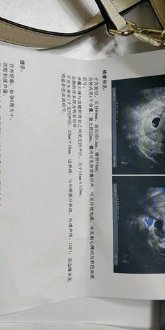 journal_insert_pic_1190613726