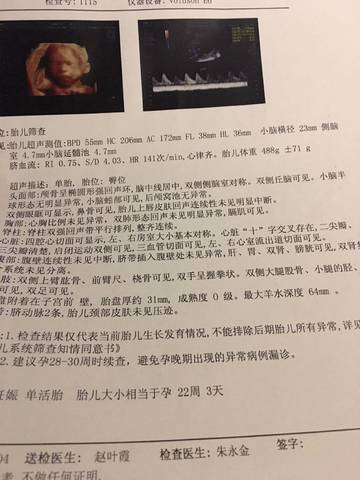 journal_insert_pic_1192975882