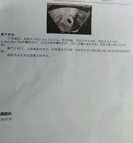 journal_insert_pic_1194031108