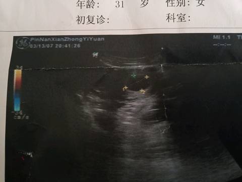journal_insert_pic_1195839092
