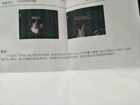 journal_insert_pic_1198136182
