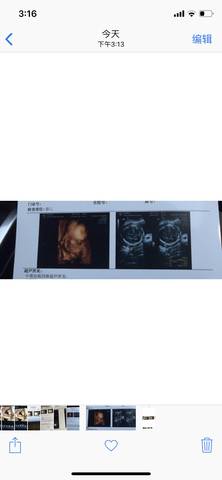 journal_insert_pic_1199843451