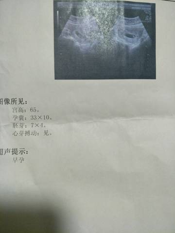 journal_insert_pic_1200595334