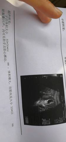 journal_insert_pic_1202891633