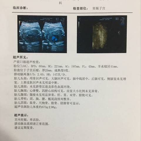 journal_insert_pic_1206629156