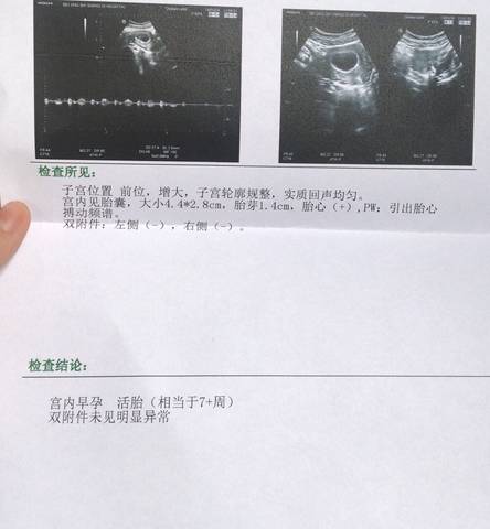 journal_insert_pic_1206623714