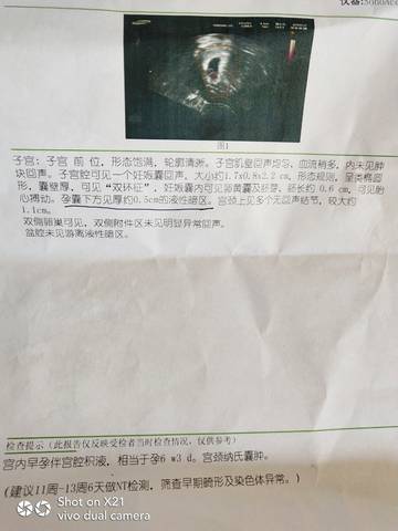 journal_insert_pic_1206645506