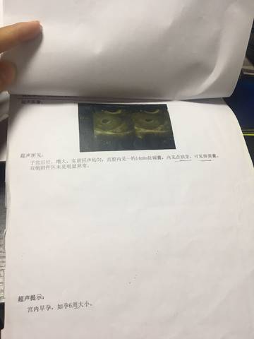 journal_insert_pic_1206665082