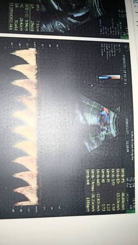 journal_insert_pic_1206878417