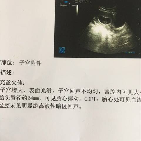 journal_insert_pic_1206518795