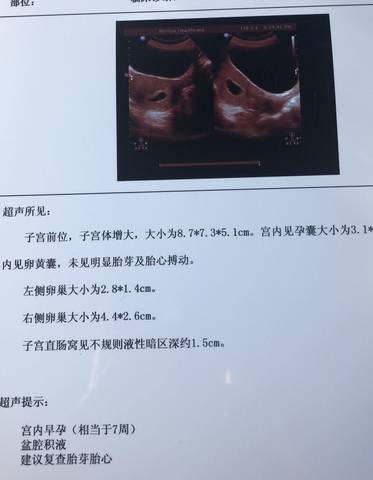 journal_insert_pic_1208493859