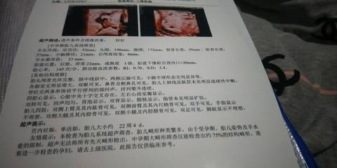journal_insert_pic_1209669131