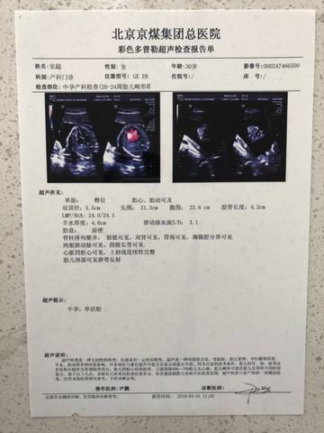 journal_insert_pic_1210568463