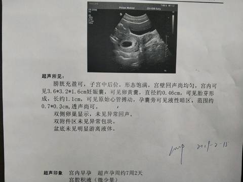 journal_insert_pic_1211122744