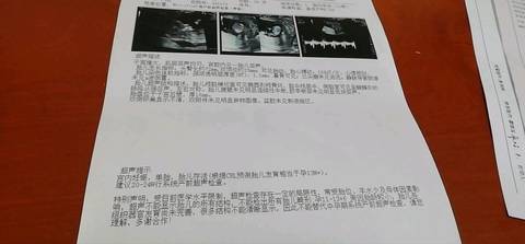 journal_insert_pic_1211741859