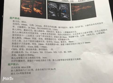 journal_insert_pic_1212847565